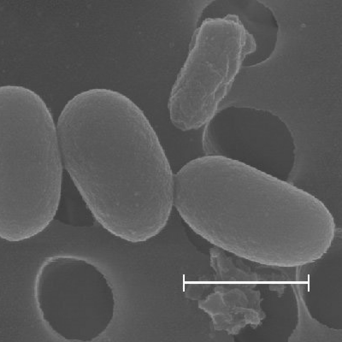 Yavru Çürüklüğü Analizi( Amerikan Yavru Çürüklüğü)